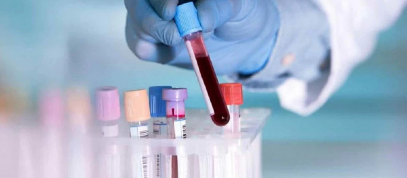 Mελλοντικό τεστ αίματος θα δείχνει κατά πόσο «δουλεύει» ένα εμβόλιο κατά της Covid-19.